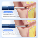 Smart Visual Spoons, Pinças De Ouvido, Limpador E Endoscópio