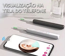 Smart Visual Spoons, Pinças De Ouvido, Limpador E Endoscópio